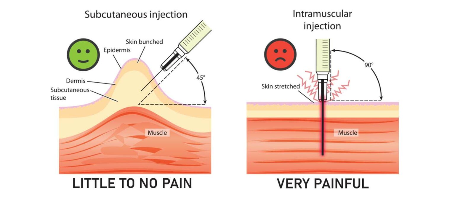 Daily Testosterone Injections vs Weekly Male Excel